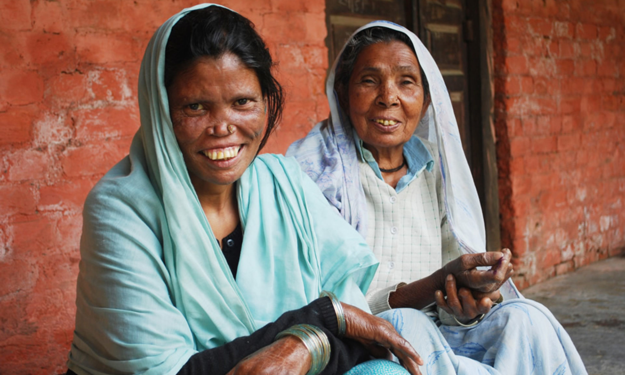 The Leprosy Mission Almora